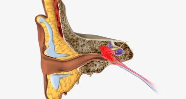 Acute otitis media is an infection and inflammation of the middle ear, usually with fluid behind the tympanic membrane.3D rendering