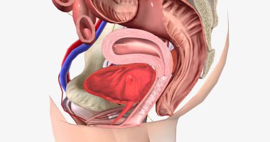Grade 0 is characterized by the normal anatomical position of both the rectum and the vagina, with no bulging present. 3D rendering