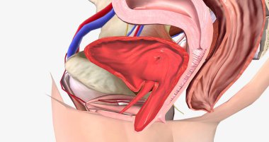 Grade 3 describes a cystocele in which the bulge passes the level of the hymen and is half-way out of the vaginal opening. 3D rendering
