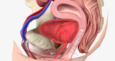 A cystocele is also known as a bladder prolapse, a fallen bladder, a prolapsed bladder, or an anterior vaginal prolapse. 3D rendering
