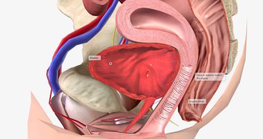 A cystocele is also known as a bladder prolapse, a fallen bladder, a prolapsed bladder, or an anterior vaginal prolapse. 3D rendering