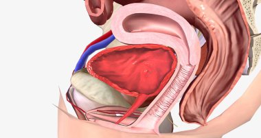 A cystocele is also known as a bladder prolapse, a fallen bladder, a prolapsed bladder, or an anterior vaginal prolapse. 3D rendering