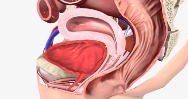 Rectum bulge extends outside vaginal space past the vaginal opening 3D rendering