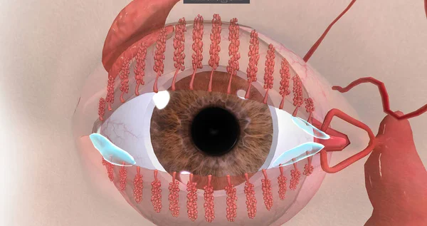 BlePharitis, tahriş, kızarıklık ve su 3D ile karakterize edilen göz kapaklarında kronik bir iltihaplanma.