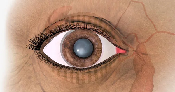 A cataract is the progressive clouding of the lens of the eye accompanied by vision problems. 3D rendering
