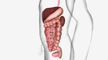 Abdominal adhezyonlar karın boşluğunda oluşan yara benzeri doku bantlarıdır.