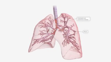 Inflammation and constriction of airways