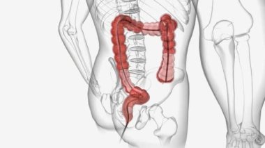 Kolonoskopi, bir doktorun rektum ve kolon içine bakmak için kolonoskop ya da dürbün kullandığı bir işlemdir..