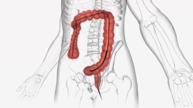 Kolonoskopi, bir doktorun rektum ve kolon içine bakmak için kolonoskop ya da dürbün kullandığı bir işlemdir..