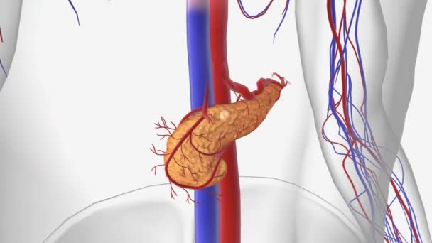 ステージI膵臓がん3Dアニメーション — ストック動画