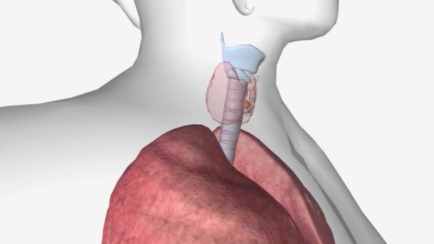 甲状腺がんステージI この段階では リンパ節 と転移の有無にかかわらず腫瘍 が記載されています — ストック動画