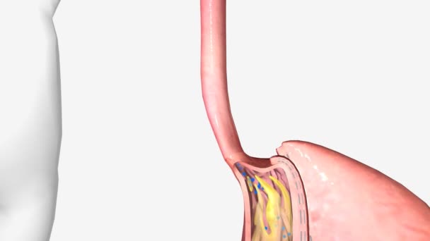Mouw Gastrectomy Esophagus Animatie — Stockvideo