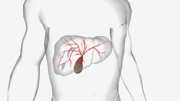 原发性胆管炎肝硬化 — 图库视频影像