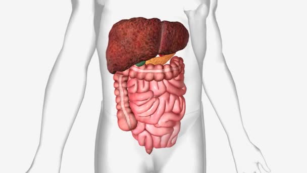 肝硬化是一种晚期肝病 在这种疾病中 健康的肝组织被疤痕组织所取代 肝脏永久受损 — 图库视频影像