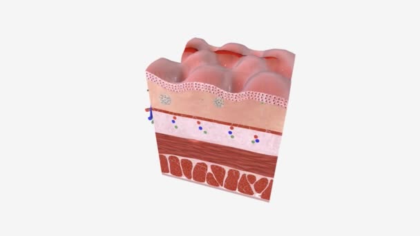 Anal Fissure Tear Split Lining Anus Anal Mucosa — Stok Video