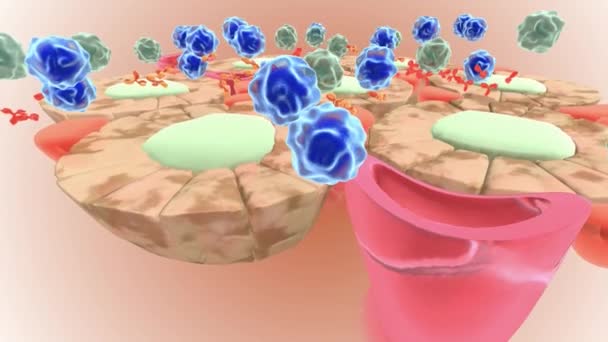 Autoimmune Attack Thyroid Cells — Vídeo de Stock