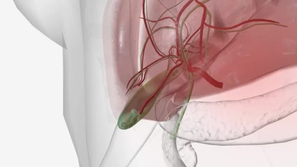 胆石症または胆石は消化液の硬化堆積物であり 胆嚢に形成されます — ストック動画