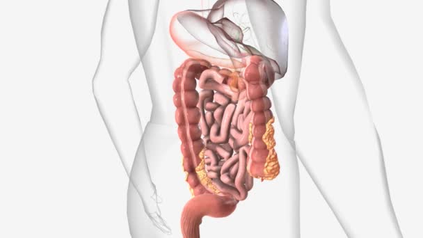 Crohn Hastalığı Bir Tür Iltihaplı Bağırsak Hastalığıdır Ibd — Stok video