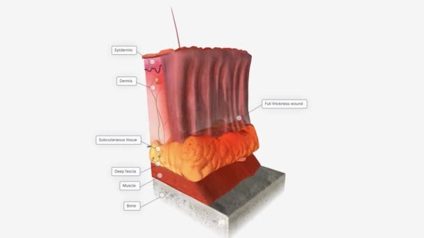 Full Thickness Wound Skin Tissue — Stock Video