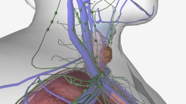 Anaplastik Farklılaşmamış Tiroid Kanserleri Diğer Alt Türlerden Çok Daha Saldırgandır — Stok video
