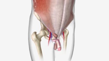 Dolaylı kasık fıtığı, kasık kanalınızın üst tarafından dolaylı olarak kasık fıtığına girer.