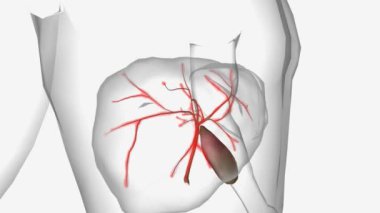 Birincil Biliary Cholangitis Siroz 3D animasyon