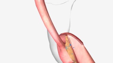 Mide baypası, yemek borusu.