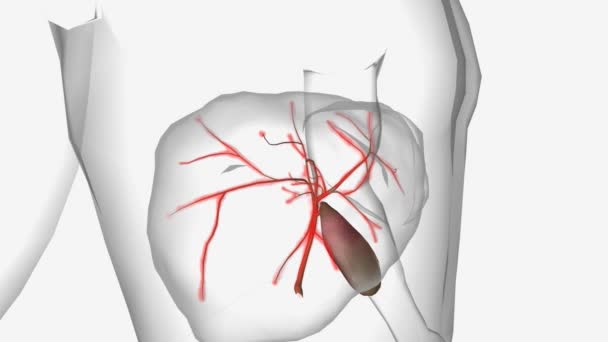 原发性胆管炎肝硬化3D动画 — 图库视频影像