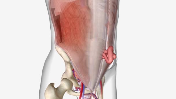 腹股沟或切口疝 特指疝 常位于腹部中部 — 图库视频影像