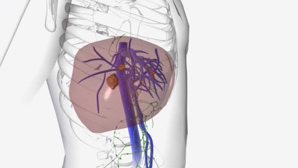 Кілька Видів Раку Можуть Утворюватися Печінці Найбільш Поширеним Типом Раку — стокове відео