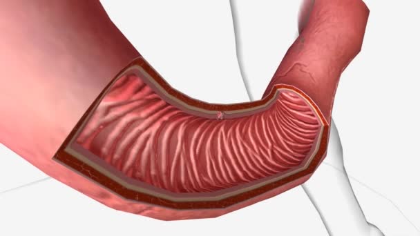 十二指腸がんは小腸腺癌とも呼ばれ 胃に最も近い小腸の一部である十二指腸に影響を及ぼすまれながんです — ストック動画