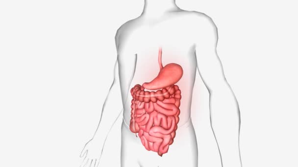 Gastroenteritis Una Inflamación Del Revestimiento Del Estómago Los Intestinos — Vídeos de Stock