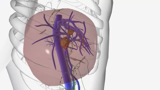 癌のいくつかのタイプは肝臓で形成することができます 肝癌の最も一般的なタイプは肝細胞癌です — ストック動画