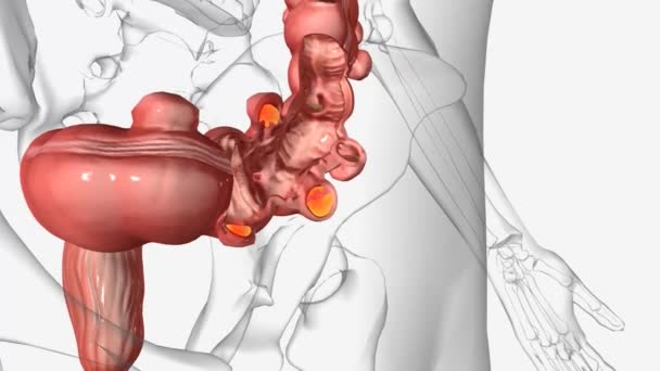 食管炎和食管炎是影响大肠 的相关消化系统疾病 — 图库视频影像