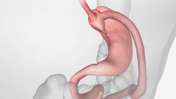 エンド サイドの腸の解剖学は TまたはY字型の接続ポイントを作成するために腸の一つ以上のカット端が垂直に向けられている手術の一種です — ストック動画