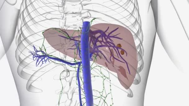 癌のいくつかのタイプは肝臓で形成することができます 肝癌の最も一般的なタイプは肝細胞癌です — ストック動画