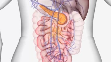 Tip 2 Diyabetli İnsülin Üretimi