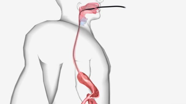 Endoskopie Ist Ein Verfahren Das Einem Arzt Ermöglicht Das Innere — Stockvideo