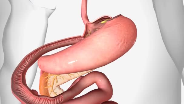 带有胃旁路3D动画的胃 — 图库视频影像