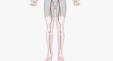Lower extremity arterial interventions are procedures designed to restore blood flow to your legs and feet. 3D rendering clipart