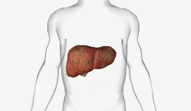 PBC is characterized by autoimmune destruction of the small and medium sized bile ducts in the liver. 3D rendering clipart