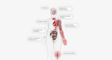 Hipotiroidizm ilk başta fark edilebilir semptomlara yol açmayabilir. 3B görüntüleme