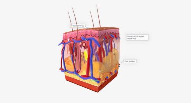 Angioedema is a swelling of the dermis and subcutaneous tissue.Anaphylaxis, Histamine Release and Vascular Edema 3D rendering