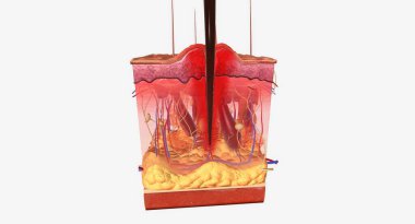 Skin reaction after insect bite 3D rendering