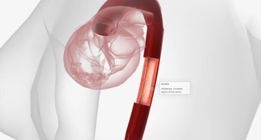 High volumes of lymphocytes, macrophages, and other immune cells infiltrate the inflamed aorta. 3D rendering