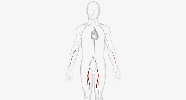 Arteries Catheter Insertion Render — стоковое фото