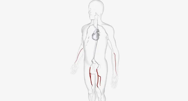 Arteri Untuk Pemasukan Catheter Render — Stok Foto