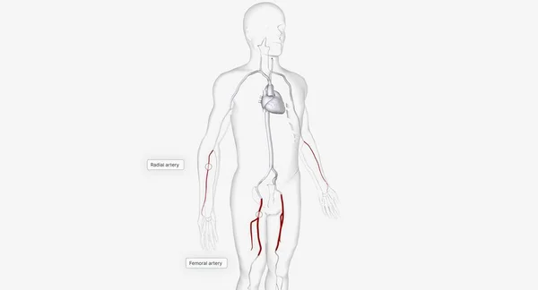 Arteri Untuk Pemasukan Catheter Render — Stok Foto