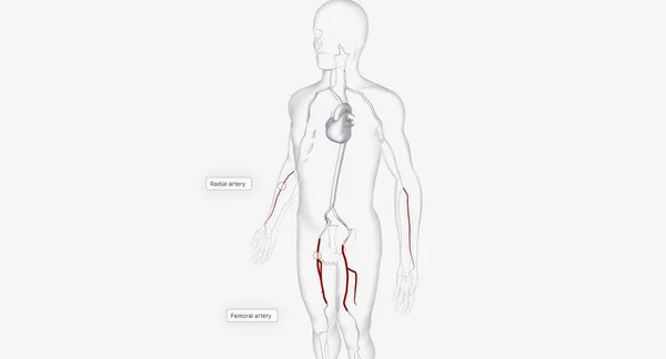 Kateter Ekleme Arterleri Boyutlu Hazırlama — Stok fotoğraf