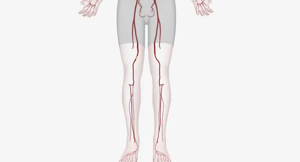 下肢動脈介入は 足と足への血流を回復するように設計された手順です 3Dレンダリング — ストック写真